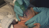 Baby Zachary needs a helping hand